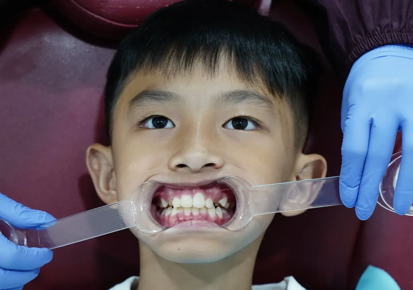 Perawatan Gigi Anak Di Klinik