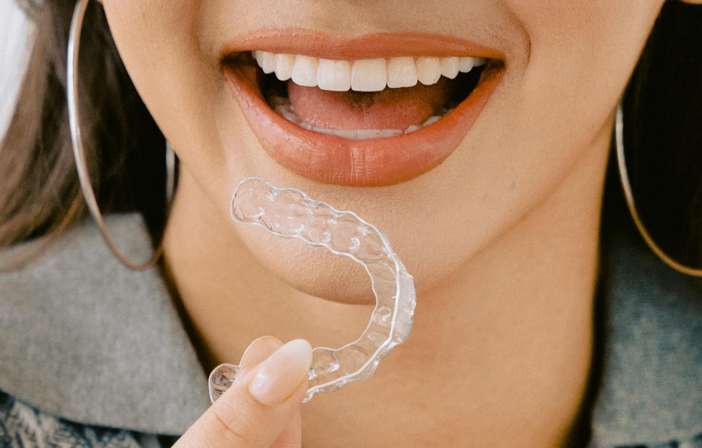 Ketahui Cara Kerja Clear Aligner untuk Meratakan Gigi