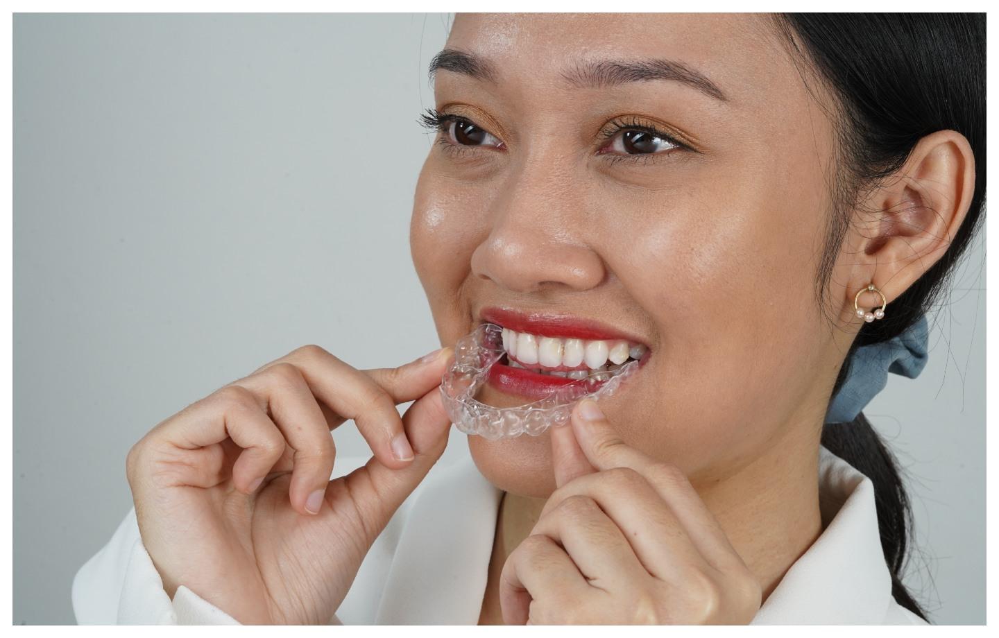 perawatan retainer gigi setelah penggunaan clear aligners